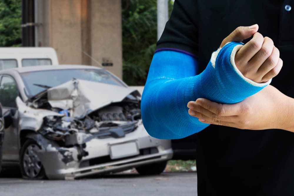 A person suffered Car Accident Injury resulted in Fracture