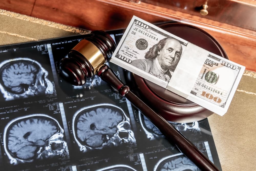 A composite image combining brain MRI scans, a gavel, and US currency, symbolizing the intersection of legal and medical concepts in personal injury cases.